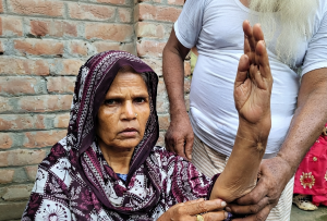 ভুল অস্ত্রোপচারের অভিযোগে চিকিৎসকের বিচারের দাবি