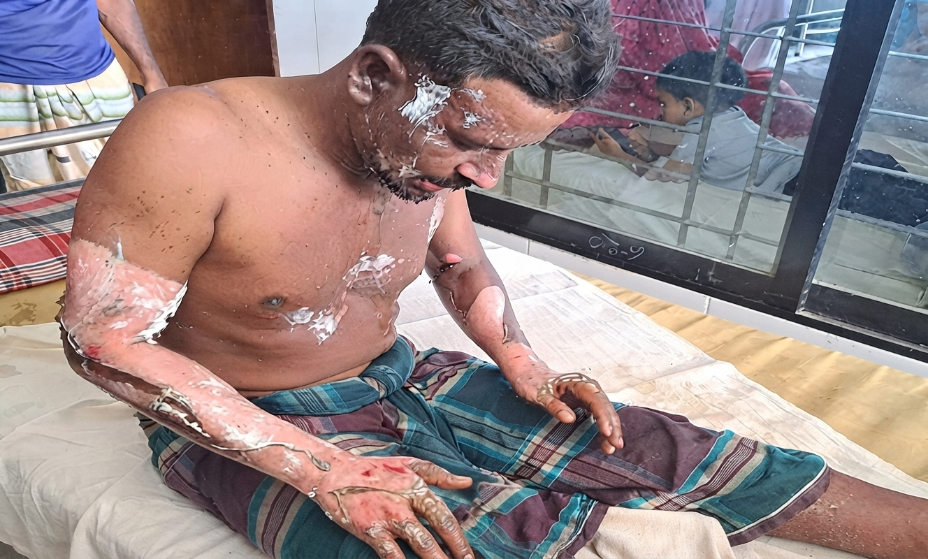 বদলগাছীতে পেট্রল ঢেলে আগুন