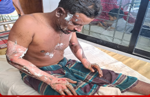 বদলগাছীতে পাখির গায়ে পেট্রল ঢেলে আগুন দেওয়ার অভিযোগ